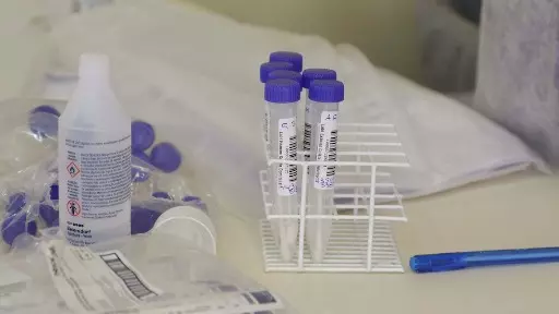 Ibaté soma 115 casos de Covid-19 em uma semana, informa boletim