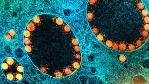 São Carlos tem 130 novos casos por Covid e 954 infecções ativas