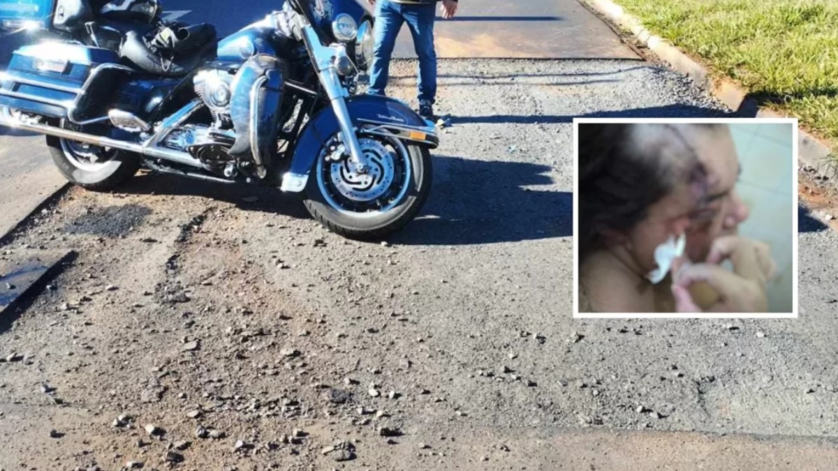 Mulher recebe 60 pontos no rosto após queda de moto provocada por asfalto inacabado
