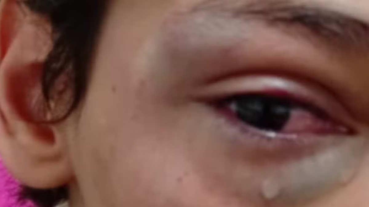 Mãe denuncia omissão de escola após filho autista ser agredido em escola de São Joaquim da Barra