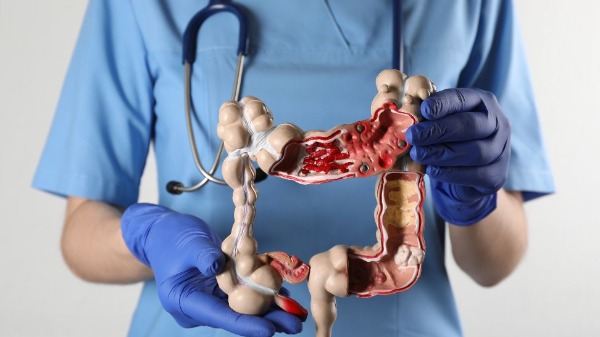 Prática regular de exercício físicos pode reduzir risco de reincidência de câncer de cólon - Foto: Africa images/Canva