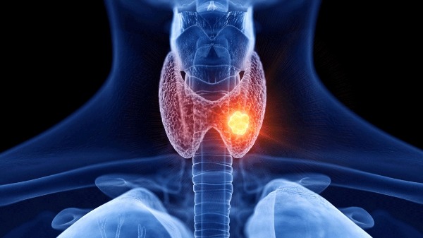 Qual a relação da glândula tireoide e a genêtica?