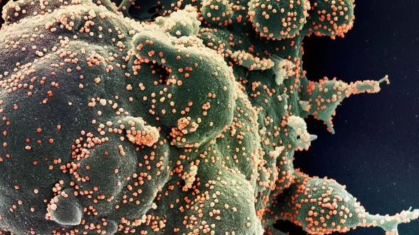 Covid-19: SP tem dois casos identificados da variante Ômicron XQ