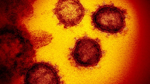 Imagem do microscópio eletrônico de transmissão mostra o SARS-CoV-2  também conhecido como 2019-nCoV, o vírus que causa o COVID-19. (Foto: NIAID-RML) - Foto: NIAID-RML