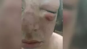 Mulher trans denuncia ter sido agredida com socos e chutes em Americana