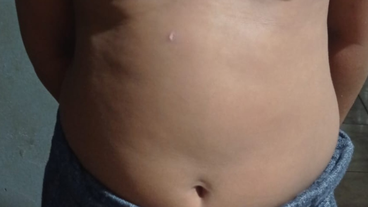 Família denuncia falta de ação de escola após menino de 10 anos ser queimado com isqueiro Família denuncia falta de ação de escola após menino de 10 anos ser queimado com isqueiro