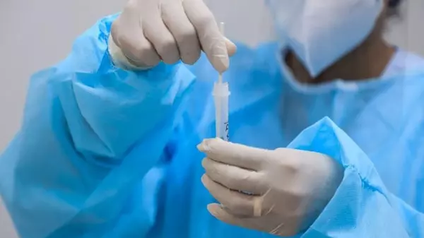 Centro epidemiológico da Unimed retoma atendimento para covid