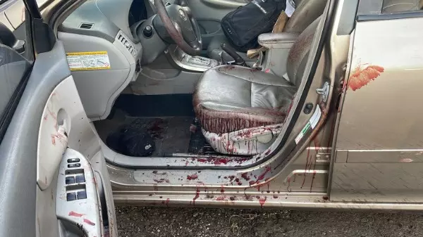 Motorista é esfaqueado em tentativa de assalto em São Carlos