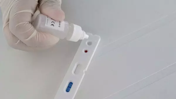 Araraquara confirma 240 novos casos de coronavírus