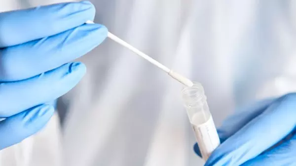 Araraquara fecha a semana com 267 casos confirmados de covid