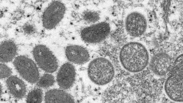 Monkeypox: Fiocruz conclui sequenciamento genético de vírus